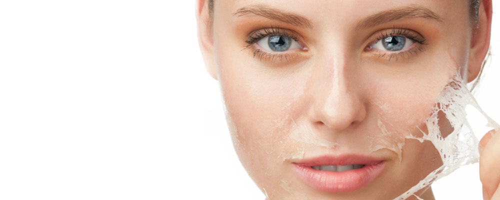 Chemical Peel