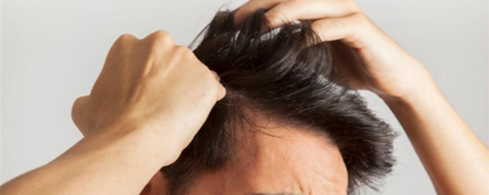 How To Do Hair Transplantation? 